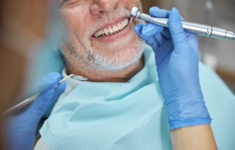 השתלת שיניים