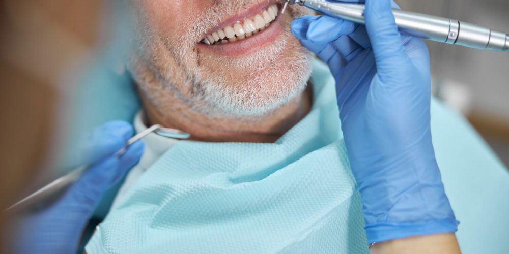 השתלת שיניים